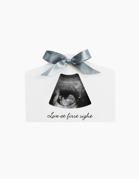 Buy Online Ultrasound Picture Frame Dooky
